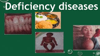 Deficiency diseases components of Food  deficiency diseases class 6 [upl. by Salvay853]