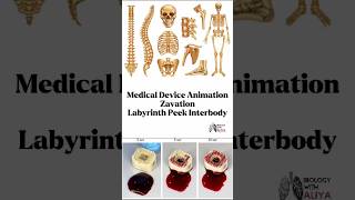 Medical Device Animation  Zavation  Labyrinth Peek Interbody medical animation 3d short [upl. by Airda]