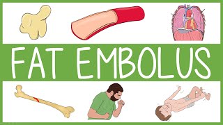 Fat Embolism Syndrome [upl. by Ellahcim]