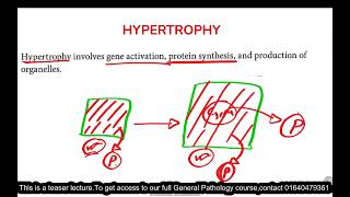 Cellular Adaptations  Growth Adaptation  Pathology  Bangla [upl. by Sioux325]