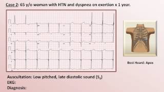 EKG and Heart Murmur Review  Part 1 [upl. by Fuller]