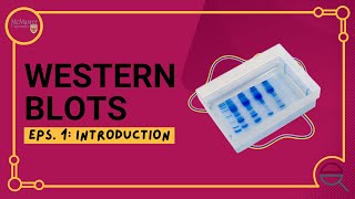 Introduction to the Western Blot [upl. by Issie]