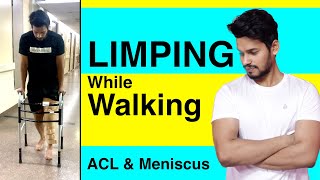 Limping After ACL Reconstruction and Meniscus Repair I Limping while walking I Surgery I Injury [upl. by Seymour40]