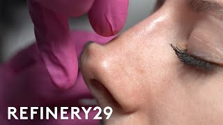 I Tried A NonSurgical Nose Job  Macro Beauty  Refinery29 [upl. by Aihsel]