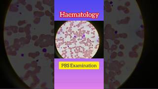 PBS Examination  Hematology  Blood Test  hematology blood shortsvideo [upl. by Wightman]