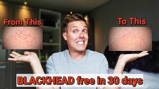 ERADICATE BLACKHEADS 30 day skincare routine for smaller pores and clear skin [upl. by Idurt]