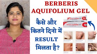 Berberis Aquifolium Gel for Acne and Scars ॥ कैसे और कितने दिनो में Result मिलता है [upl. by Pardoes]