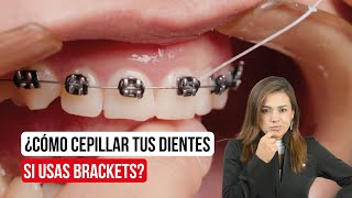 ¿Cómo me cepillo si tengo brackets 🤔 [upl. by Atlas]