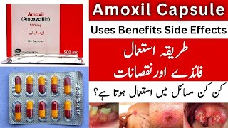 Amoxil capsule uses in urduAmoxil 250mg capsule amp Amoxil 500mg capsule use in urdu [upl. by Davidson993]