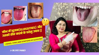 जीभ में सूजनGLOSSITIES और उसको ठीक करने के घरेलु उपाय [upl. by Nifares]