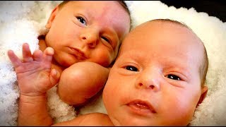 PREEMIE TWINS Cuteness Overload  Dr Paul [upl. by Suoirad]