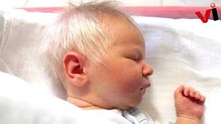 WhiteHaired Baby Surprises Doctors Until They Realize [upl. by Head]