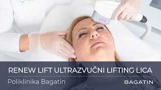 Renew Lift ultrazvučni lifting lica  Poliklinika Bagatin [upl. by Anastas]