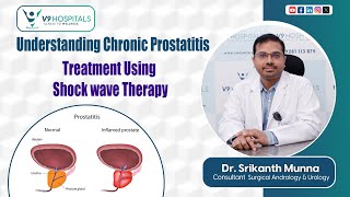 Understanding Chronic Prostatitis Treatment using Shock wave Therapy  health v9hospitals [upl. by Rednav646]