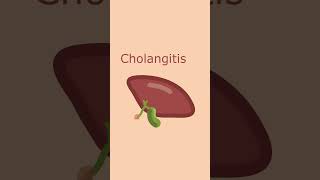 Cholangitis vs Cholecystitis  Short Comparison science biology anatomy medicine [upl. by Enirok]