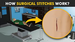 How Stitches Work In Body 3D Animation  Healing Process Of Surgical Wounds [upl. by Esinahs619]