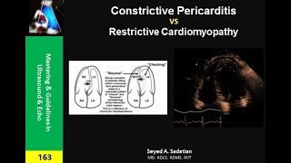 Constrictive Pericarditis vs Restrictive Cardiomyopathy [upl. by Fortune]