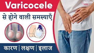 Fungal Infection Treatment In Hindi  फ़ंगल इन्फ़ेक्शन का इलाज हिंदी में  Dermatologist  Dr Sunil [upl. by Halyak]