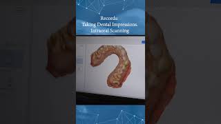 Records Taking Dental Impressions Intraoral Scanning [upl. by Kushner]