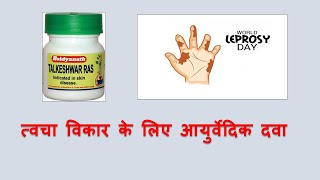 Talkeshwar ras l Leprosy l ayurvedictreatment ayurveda ayurvedicmedicines [upl. by Sela330]