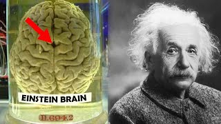 How Einsteins Brain was Different [upl. by Newfeld]