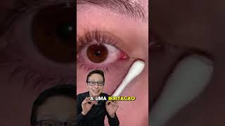 O Que é Isso no Olho 😯👁️medico enfermagem saude curiosidades [upl. by Dnomde]