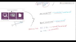 Weber and Rinne Tuning Fork tests for USMLE [upl. by Ahsitil601]