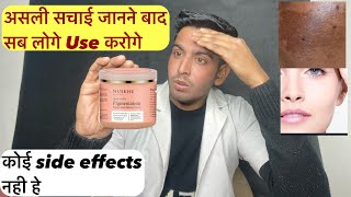 पिग्मेंटेशन को जल्दी ख़त्म करगी क्रीम  nuskhe pigmentation cream  nuskhe by paras prudents review [upl. by Attikin107]