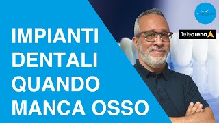 Impianti dentali quando manca osso  Prof Makarati a Dica33  Telearena [upl. by Romy209]