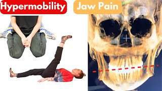 Jaw Pain and Hypermobility Is it ALL connected [upl. by Enuahs285]