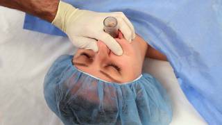 NuMask in Anesthesiology IntraOral Mask IOM®  Oropharyngeal Airway OPA Training Video [upl. by Elton]