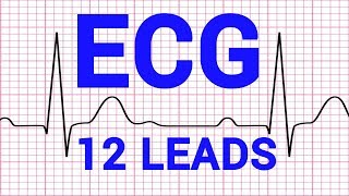 02 ECG  12 LEADS OF ECG  CARDIOVASCULAR PHYSIOLOGY [upl. by Lars491]