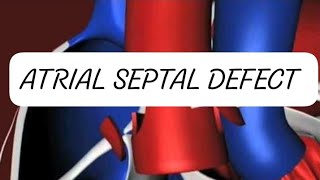 ATRIAL SEPTAL DEFECT CONGENITAL HEART DISEASE [upl. by Amalburga]