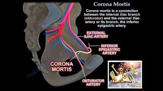 Corona Mortis  Everything You Need To Know  Dr Nabil Ebraheim [upl. by Idnahc757]