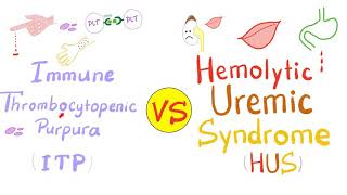 Immune Thrombocytopenia ITP vs Hemolytic Uremic Syndrome HUS [upl. by Peih922]