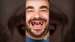 Dientes de tus antepasados 👉🦷 curiosidades [upl. by Eemak353]