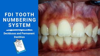 FDI Tooth Notation System  Tooth numbering system [upl. by Tadich]