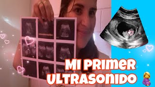 MI PRIMER ULTRASONIDO 🥺🤰 ultrasonido embarazo familia vlog viralvideo [upl. by Anemolihp]