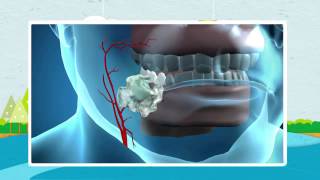 How Nicorette Works [upl. by Coletta]