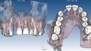 01042017 Szkolenie Tomografia CBCT  BZWBK Panoramik CD Planmeca KolDental [upl. by Yelyah]