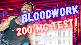 WHAT TO EXPECT ON 200 mg TESTOSTERONE per week  Bloodwork and How I feel after 4 months on 200mg [upl. by Hocker797]