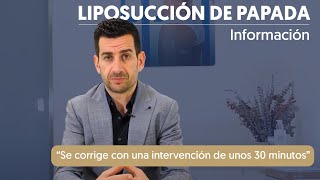 Liposucción de papada I Información [upl. by Barnett754]