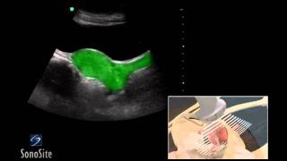 How To Female Pelvis Ultrasound Exam 3D Video [upl. by Aliwt]