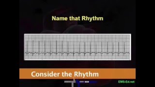 Intro EKG Interpretation Part 2 [upl. by Nalhsa]