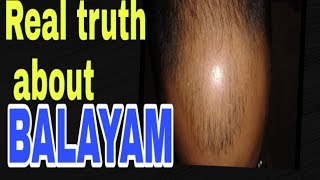 balayam yoga nail rubbing exercise for hair falling out and alopeciaHindi [upl. by Abibah30]