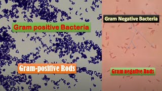 Gram Negative and Gram Postive bacteria under the Microscope [upl. by Eirised998]