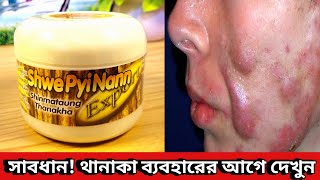 Thanaka Face Pack Review  মিয়ানমারের থানাকা ব্যবহার করে কেমন রেজাল্ট পেলাম Thanka Facepack [upl. by Yenttirb]