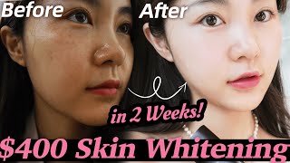 REAL EXPERIENCE kpop idols whitening treatment Unexpected results 🤯  Lyn Beauty [upl. by Ossie]