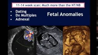 AIUM Webinar Systematic Evaluation of the 1114 Week Fetus Touching on ISUOG Guidelines [upl. by Nagaek996]