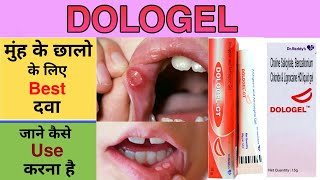 dologel gel uses in hindi  dologel ct gel uses in hindi  dologel how to use  dologel ct [upl. by Haberman]